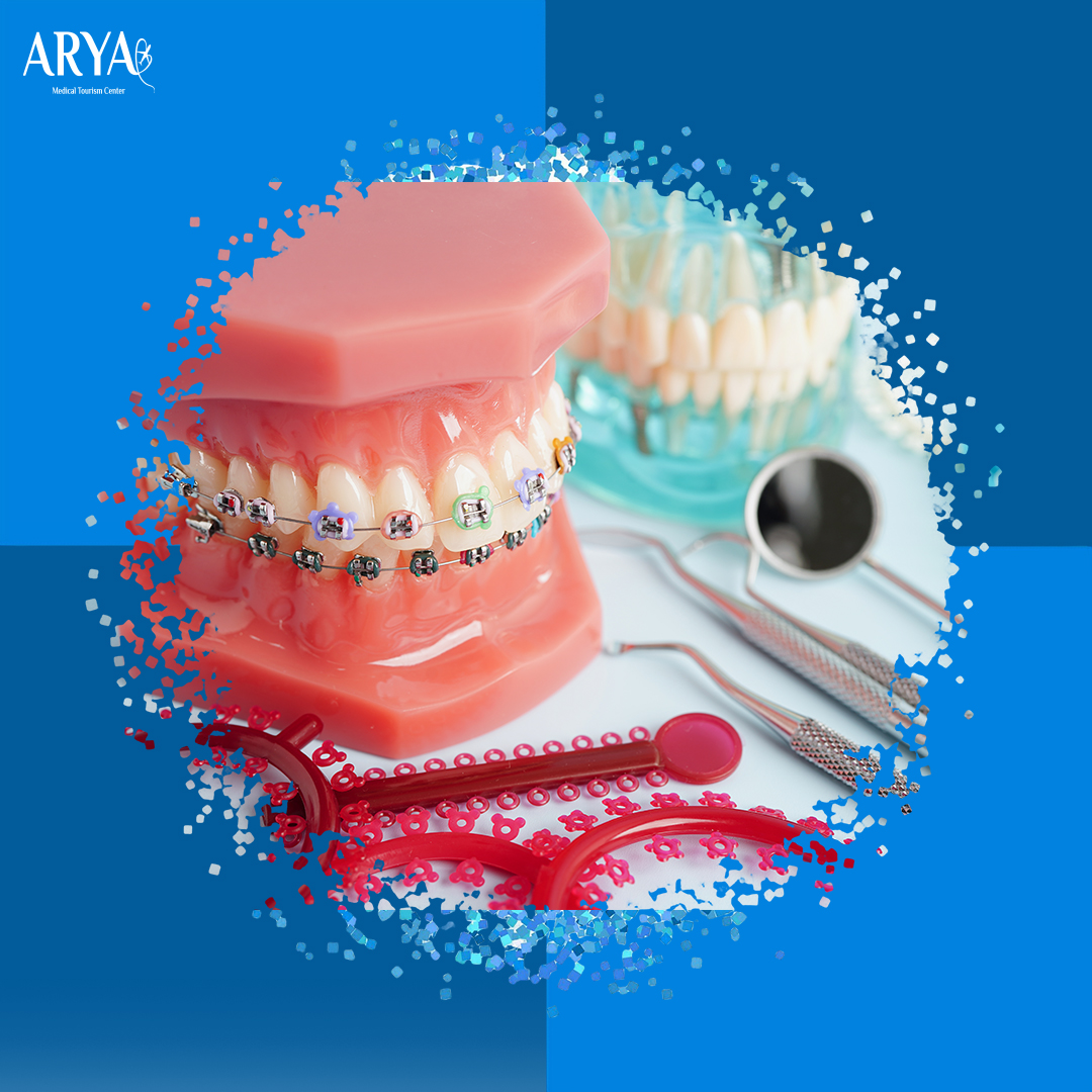 تقويم الأسنان